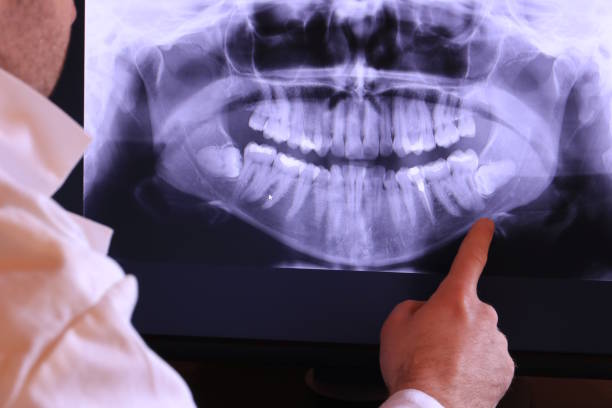 Best Dentist for Tooth Abscess  in Monsey, NY