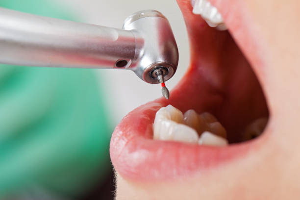 Best Broken Tooth Emergency  in Monsey, NY